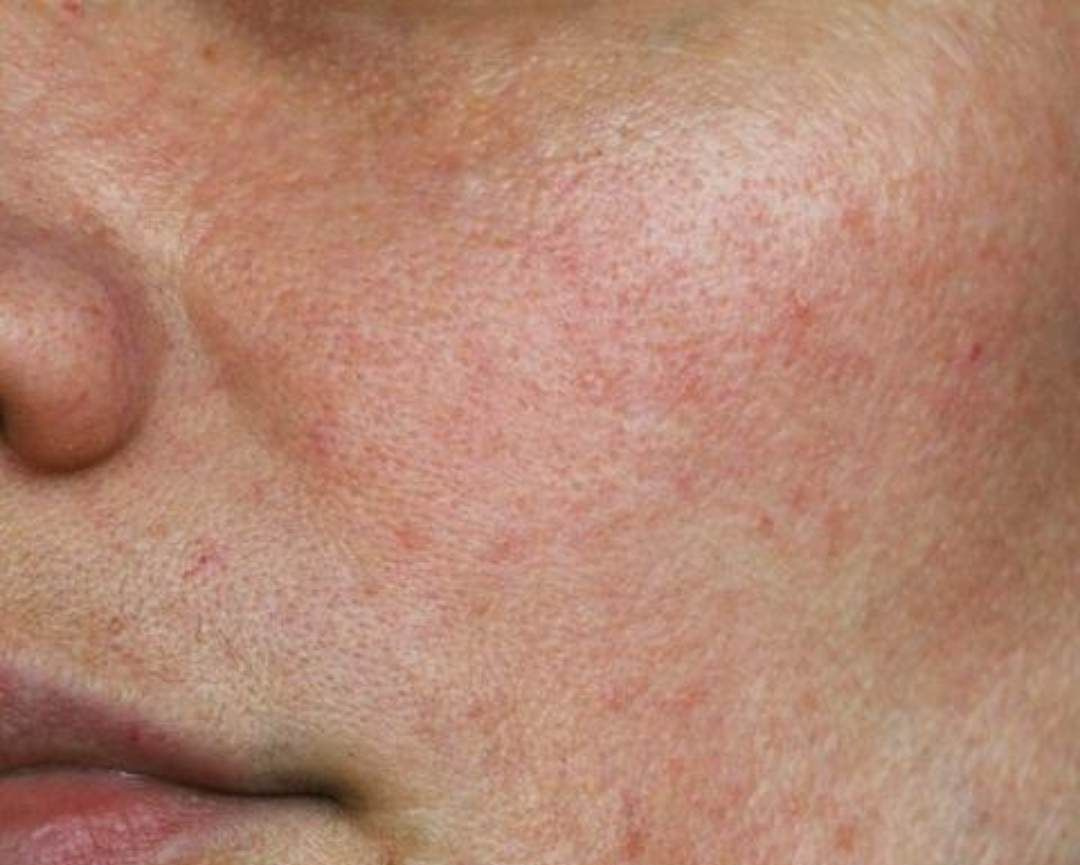 Sensitive Skin Regimen Box