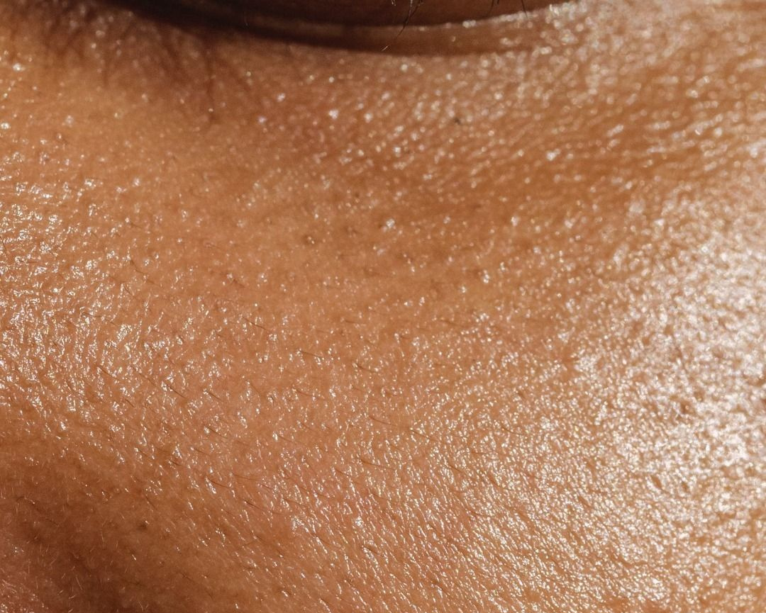 Vette Huid Regimen Box